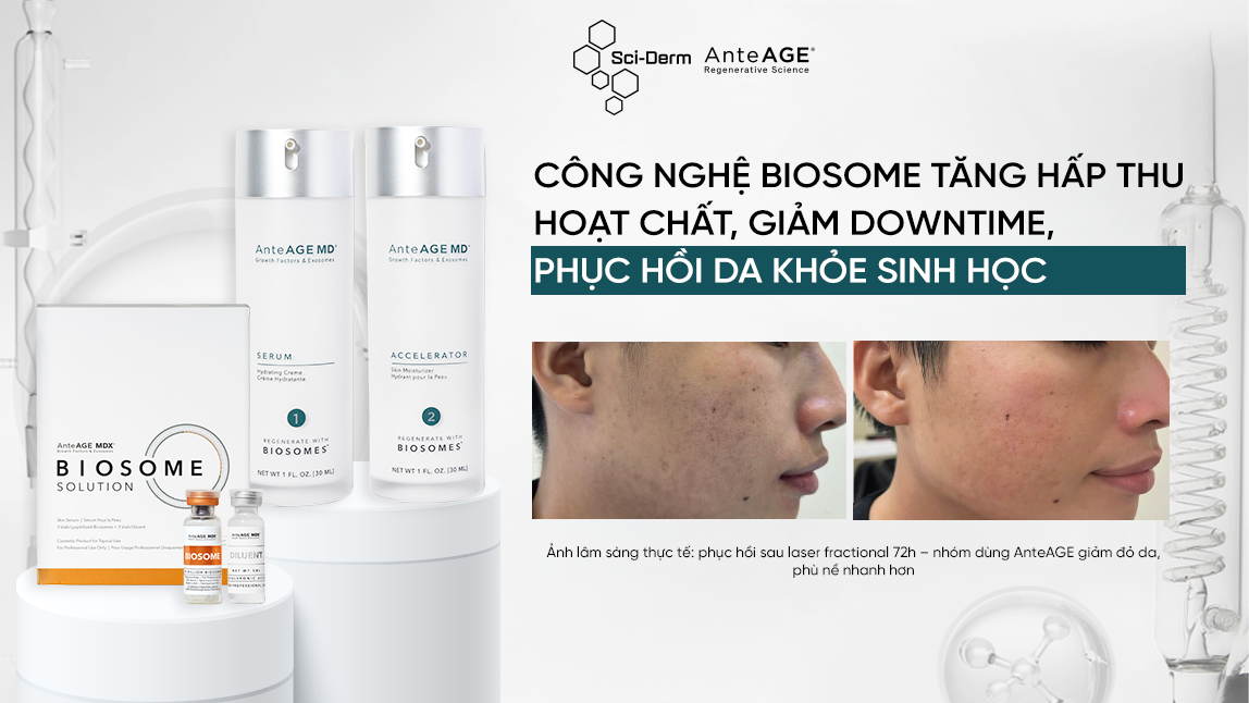 AnteAGE - HNDL toàn quốc